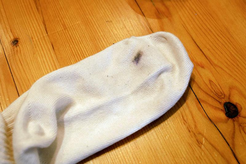 靴下の汚れをダーニング